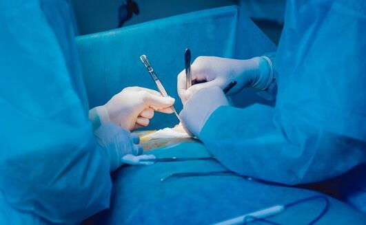 Penis enlargement surgery execution